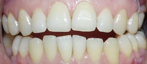 Yiran H before