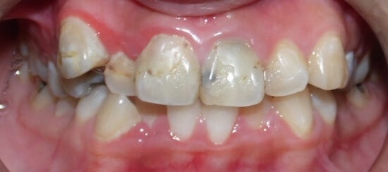 Before