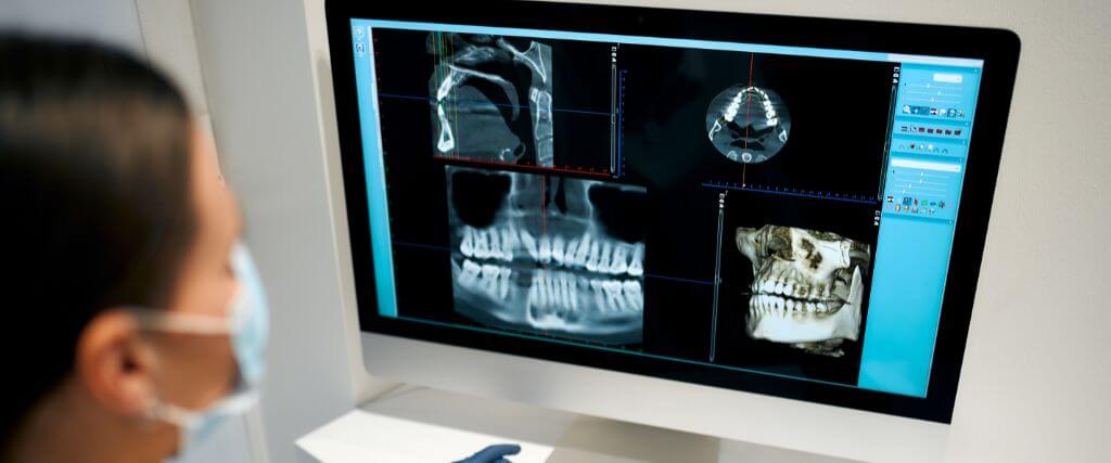 Dental X-Rays: The 4 Different Types and Their Use
