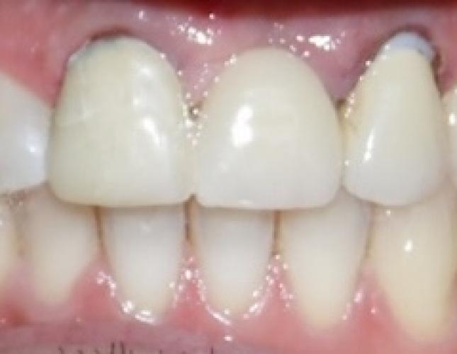 Rodrigo T after Rodrigo T after