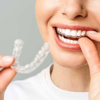 Invisalign